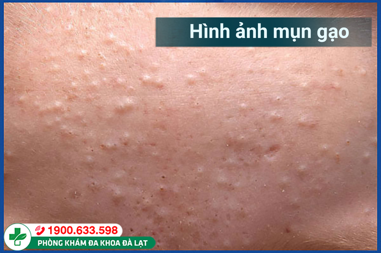 Block Image